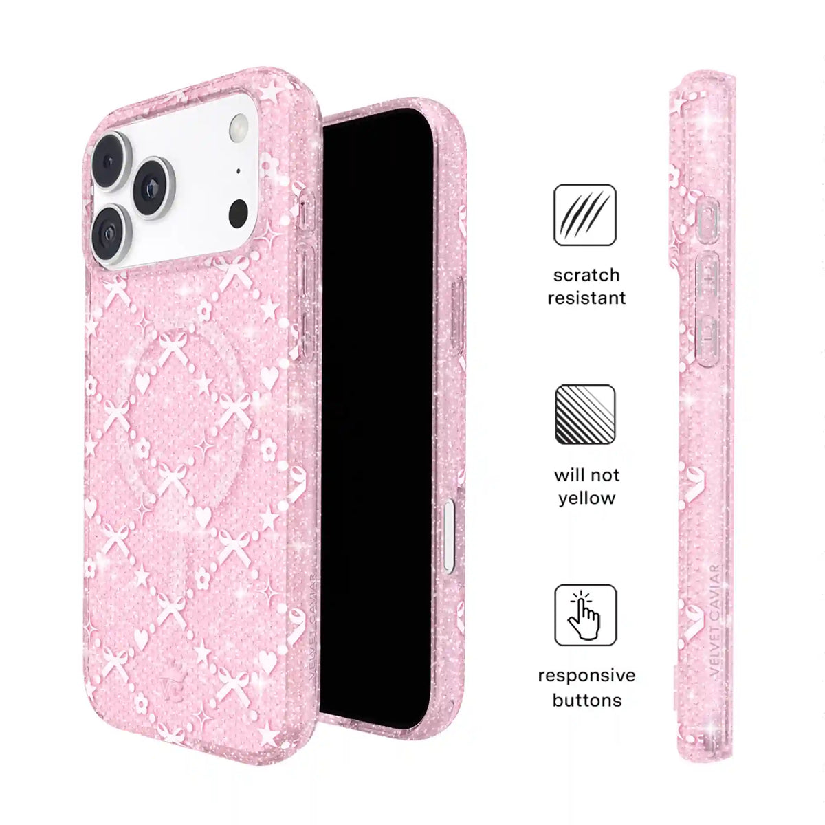 Sugar Baby Glitter iPhone Case